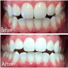 Lakebrink Dental