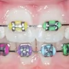Parle Orthodontics