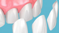 Cosmetic Dentistry