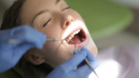 Dental Cleaning