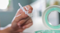 Invisalign