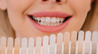 Cosmetic Dentistry