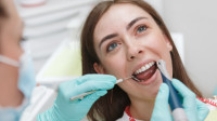 Composite Fillings