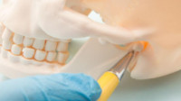 TMJ Treatment