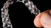 Invisalign