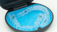 Invisalign