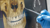 Restorative Dentistry
