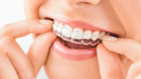Orthodontics