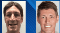 All-on-4 Implants
