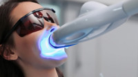 Teeth Whitening