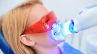 Teeth Whitening
