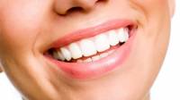 Tooth Whitening